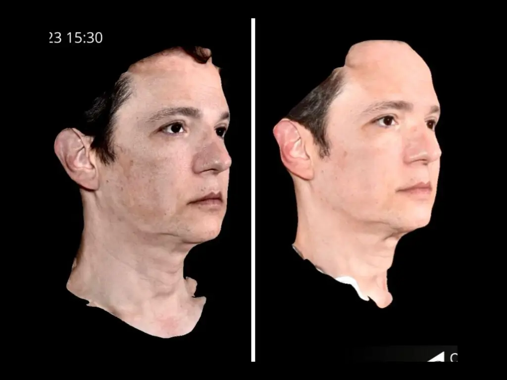 ad 2